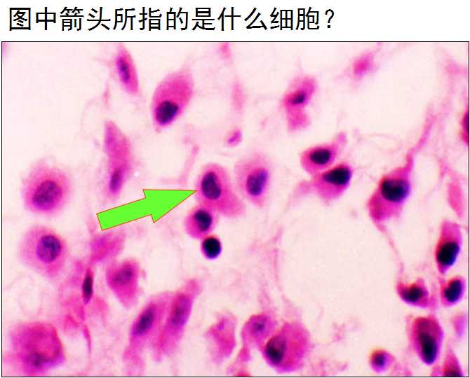 成纤维细胞 c. 巨噬细胞 d. 肥大细胞