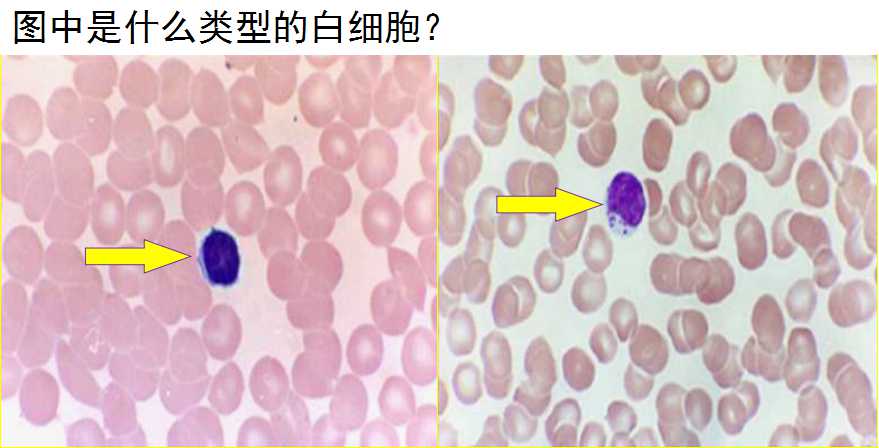 嗜碱性粒细胞 c. 淋巴细胞 d. 单核细胞