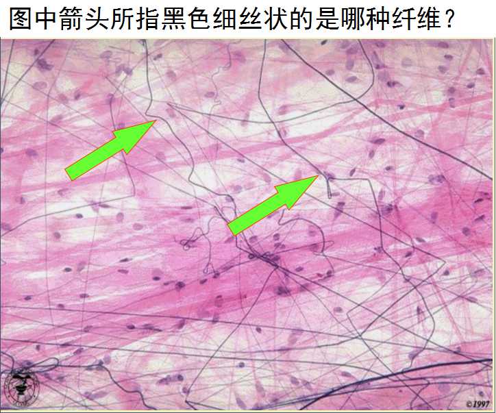 胶原纤维 b. 弹性纤维 c. 网状纤维 d. 蛋白多糖