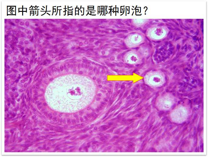 初级卵泡 c. 次级卵泡 d. 成熟卵泡