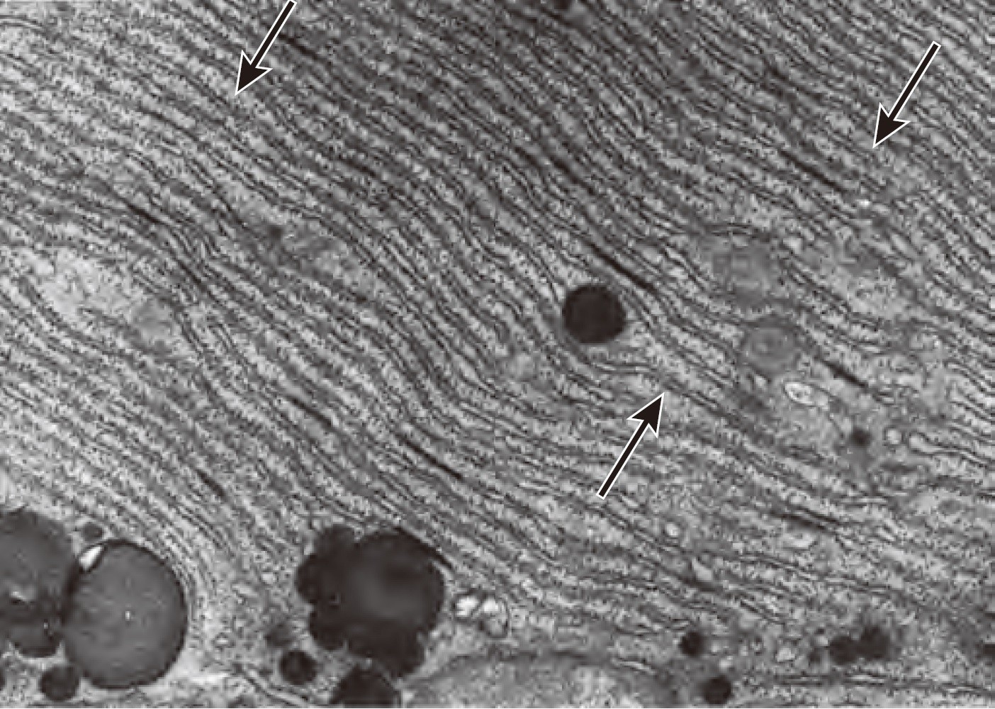 利用透射电镜观察肝细胞,可见许多球状突起的平行线(如图箭头所示)