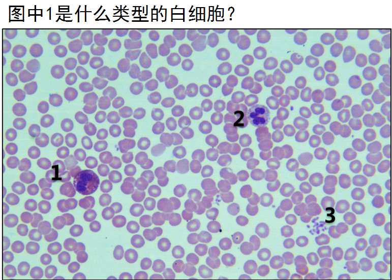 a. 中性粒细胞 b. 嗜酸性粒细胞 c. 嗜碱性粒细胞 d. 淋巴细胞