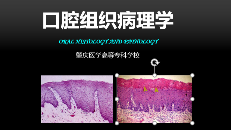 口腔组织病理学答案