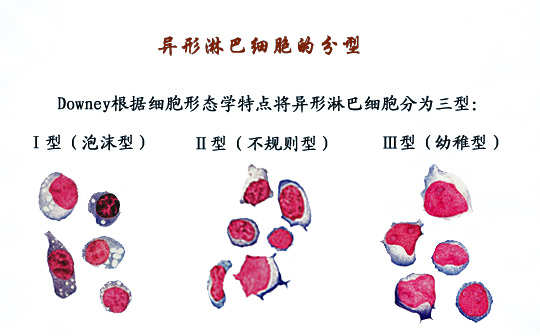 异淋分型 - 智慧职教